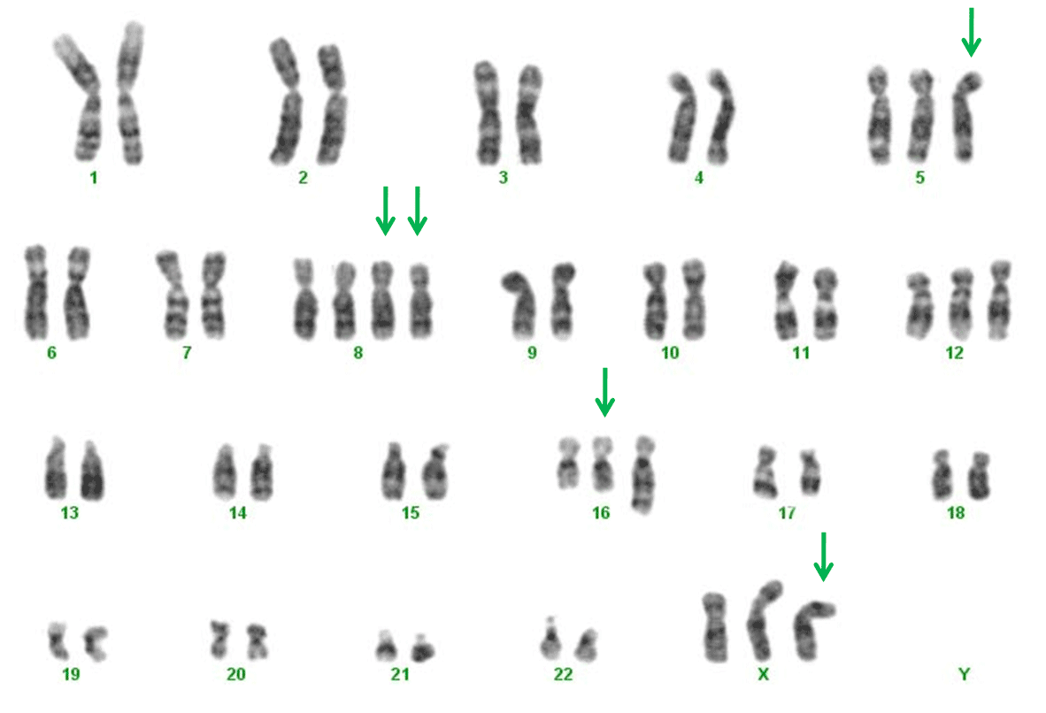 Karyotyping